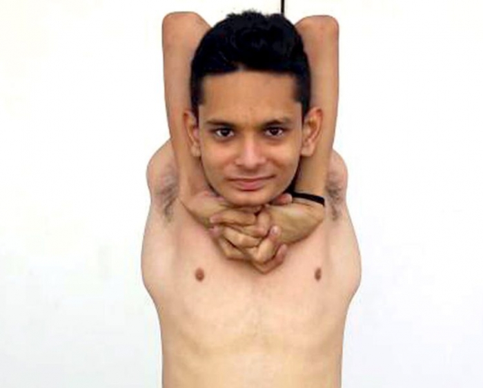«Резиновый мальчик» может вращать своими плечами на 360 градусов и крутить головой