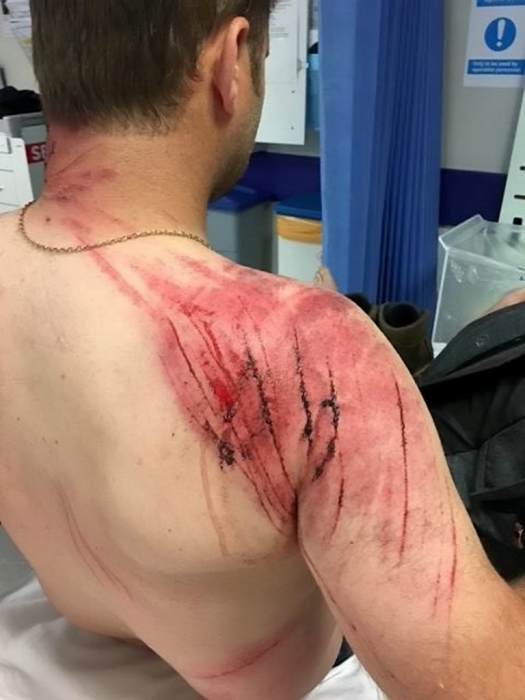 Мужчина обнаруживает раны по всему телу после того, как его бодали коровы