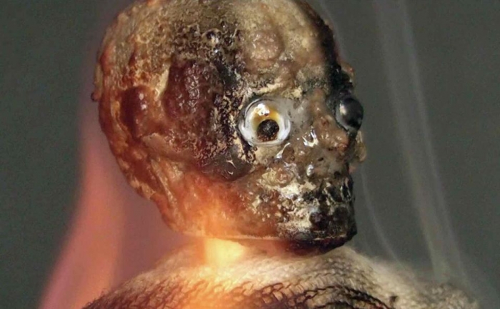 Спонтанное возгорание человека существует и человек сгорает «как зажигательная бомба», утверждает ведущий ученый