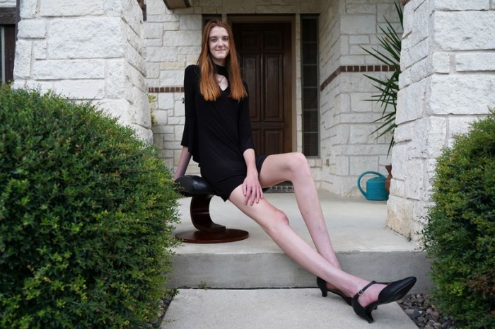 Американская девушка-подросток с рекордно длинными ногами призывает людей «принять» её отличия